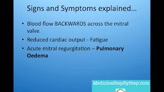 Understanding Mitral Regurgitation Signs and Symptoms [upl. by Attenod]