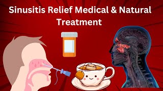 Sinusitis Relief Medical amp Natural Treatment [upl. by Leima]