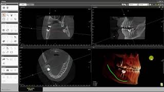 Software  Triana™Saving Captured Images [upl. by Neyr509]