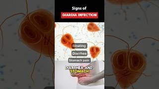 IBS Symptoms or Giardia Parasite Infection guthealth youtubeshorts shorts [upl. by Beauregard685]