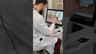 DRAWING THE MARGINS ON CEREC PRIMESCAN FOR FULL MOUTH RECONSTRUCTION cosmeticdentist [upl. by Hussey]