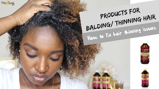 How to Help Thinning Hair  Groganics DHT Blocker System [upl. by Aikahs400]