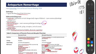 Antepartum Hemorrhage Obstetrics  UWorld questions 📝 OB14OB16 [upl. by Simonetta]