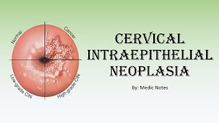 OampG Cervical intraepithelial neoplasia  for medical students [upl. by Janifer942]