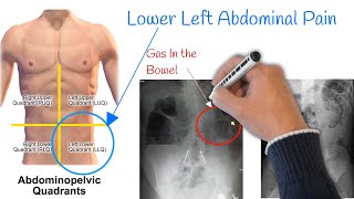 Pain in lower left abdomen  Low Stomach Pain Most Common Causes [upl. by Gabriella]