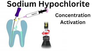 Sodium Hypochlorite Irrigation in Endodontics Part 1 Advantage Disadv Concentration amp Activation [upl. by Ulani]