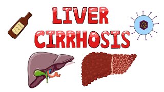 Liver Cirrhosis  What happens in Liver Cirrhosis  Pathophysiology Causes Signs amp Symptoms [upl. by Eelirem]