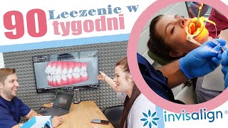 Niewidoczny aparat CZY TO BOLI Jak wygląda założenie aparatu ortodontycznego invisalign [upl. by Wiggins315]