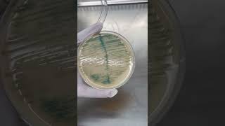 Burkholderia cepacia Trên Môi Trường Thạch UTI  Điều Bạn Cần Biết shorts labinsight [upl. by Hilliary]