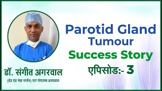 Success Story Successful Complex Parotid Tumor Surgeries [upl. by Sitarski]