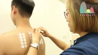 skin patch test hong kong allergen patch test  MedDx Allergy hong kong [upl. by Acsisnarf779]