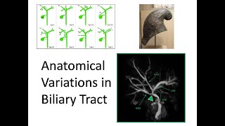 ANATOMICAL VARIATIONS IN BILIARY TRACT [upl. by Ede485]