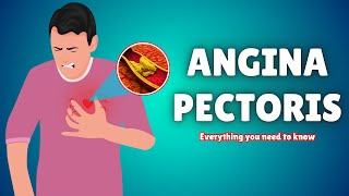 Whats Hiding Behind Your Chest Pain is Angina Pectoris [upl. by Klayman806]