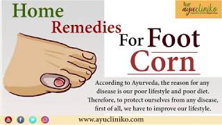 Natural Ayurvedic Home Remedies for Foot Corn and Calluses [upl. by Levine]