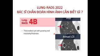 LUNGRADS 2022 BÁC SĨ CHẨN ĐOÁN HÌNH ẢNH CẦN BIẾT GÌ  P1 LUNGRADS là gì và khi nào cần áp dụng [upl. by Orelu470]