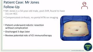 Expert Perspectives The Role of Immunotherapy in Advancing the Treatment of HCC and BTC [upl. by Falkner]