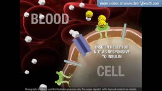 Diabetes Sulfonylureas medication [upl. by Newsom]