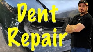 Dent Repair  QampA DIY How Do I Repair Dent at Home Myself [upl. by Sherurd]