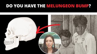 5 Common Traits of Melungeon Descent [upl. by Aidualk]