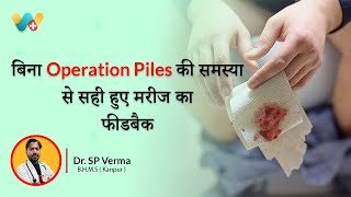 Piles ka homeopathy Ilaj  Pinki Ji ki Success Story  बवासीर का होमियोपैथी इलाज 233177 [upl. by Merlin]