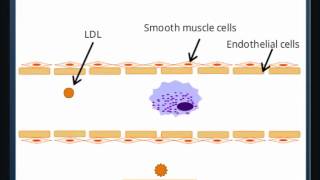 Atherosclerosis [upl. by Ladnyc467]