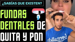 FUNDAS DENTALES de poner y quitar  ¿Conocías su existencia [upl. by Xineohp]