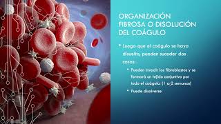 HEMOSTASIA y COAGULACIÓN SANGUÍNEA  GUYTON FISIOLOGÍA [upl. by Jez]