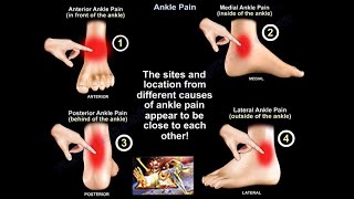 Ankle Pain  Everything You Need To Know  Dr Nabil Ebraheim [upl. by Imer86]