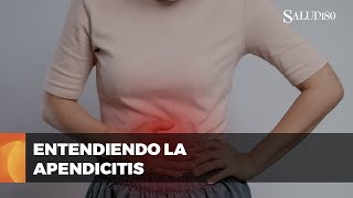 ✅ ¡Lo que debes saber sobre la APENDICITIS y cuidados postcirugía  Salud 180 🌿 [upl. by Notsehc]