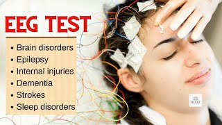 EEG test How brain is tested is that safe how EEG test is done [upl. by Whitford]