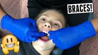 Our 10 Year Old Is Getting Braces [upl. by Niltiak]