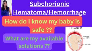 Subchorionic Hematoma My baby is safe or not Medications for Subchorionic hematoma [upl. by Warms509]