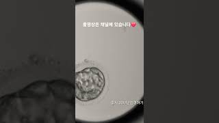 모자이시즘 배아 분열과정 Embryoscope timelapse 시험관 난임 5일배양 모자이시즘 pgt염색체 배아분열과정 [upl. by Chimene]