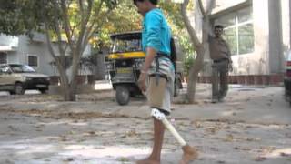 Jaipur Foot [upl. by Hafirahs]