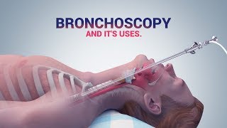 BRONCHOSCOPY  ITS USES I DR NAVEEN KUMAR AILAWADI I CHEST SPECIALIST [upl. by Shu236]