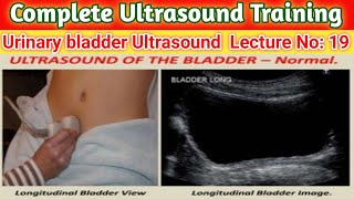 Urinary bladder Ultrasound  Bladder Scan  usg  Sonography [upl. by Akinnej]