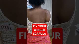 winging of scapula Physiotherapy DrKinjalParmarPT scapularwinging drkinjalparmarptscapularpain [upl. by Dias]