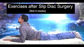 Exercises after Slip Disc Surgery first 4 weeks [upl. by Henriha888]