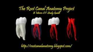 Mandibular First Molar  Prof Dr Marco Versiani [upl. by Revorg]