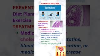 Atherosclerosis neetpg neet usmleprep usmle [upl. by Anelis]