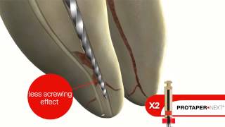 DENTSPLY ProTaper Next [upl. by Sitnik]