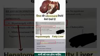 लिवर की ultrasound report देखना सीखे  Hepatomegaly Fatty liver ultrasound diagnosis [upl. by Joella323]