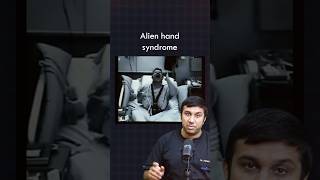 What is an Alien Hand Syndrome [upl. by Keane19]