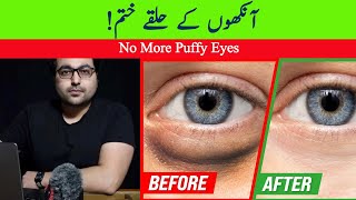 Dr ZeeHow to Get Rid of Puffy Eyes and Dark Circles  डॉक्टर ज़ी [upl. by Llenna]