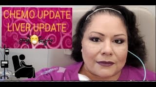 Chemo amp Liver Update  Cancer Vlog [upl. by Auqenahs]