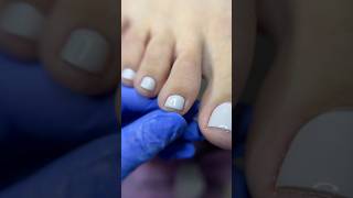 Pedicure transformation pedicure nailcare foot [upl. by Emmerie571]