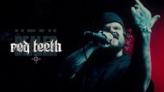 DEALER  RED TEETH Official Music Video [upl. by Cohbath275]