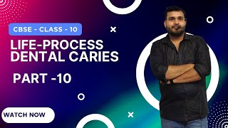 Life Processes Class 10 Science Biology  Lecture10  CBSE Board  Devendra Sir [upl. by Keven]