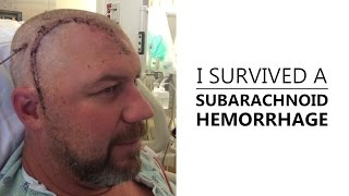 I Survived A Subarachnoid Hemorrhage [upl. by Hazel]