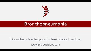 Bronchopneumonia • Lobularna pneumonija [upl. by Nylsaj594]